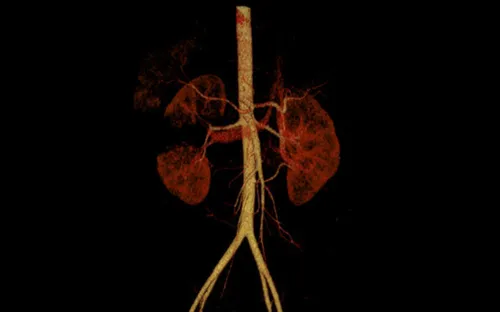 Trượt chân ngã lúc chơi đùa, bé 10 tuổi bị vỡ thận