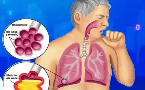 Tăng cường phát hiện bệnh lao, giảm nguy cơ lây cộng đồng