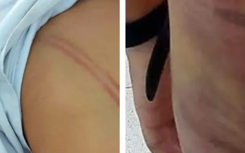 Chủ tịch tỉnh Cà Mau chỉ đạo xử lý nghiêm vụ mẹ kế đánh con chồng