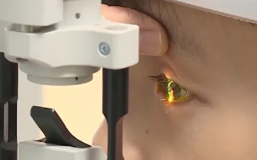 Hải Dương: Số ca mắc đau mắt đỏ tăng cao tại huyện Thanh Miện