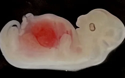 Các nhà khoa học đã “nuôi cấy thận” trong phôi lợn như thế nào?