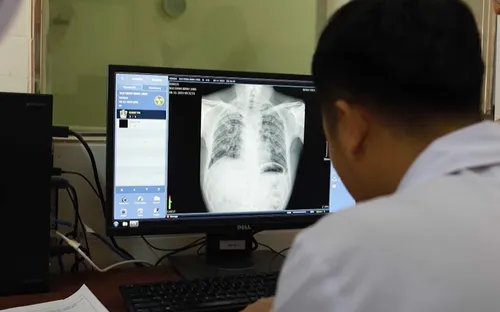 Nghệ An: Phát hiện thêm nhiều công nhân mắc bệnh bụi phổi