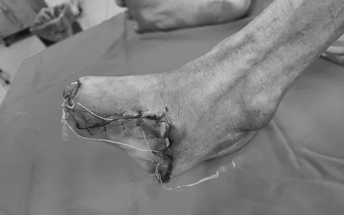 Nguy hiểm khôn lường khi dùng thuốc đông y điều trị không đúng chỉ định