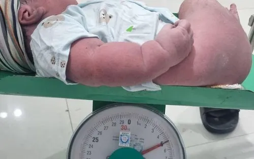Hy hữu: Sản phụ đẻ thường lần thứ 6, hạ sinh bé trai nặng 5kg