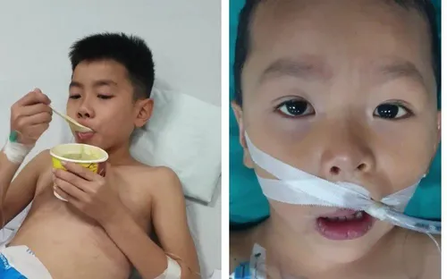 Tiếp vụ hai cháu bé ở Thanh Hóa hôn mê sau ăn bim bim lạ: Chuyển biến tích cực