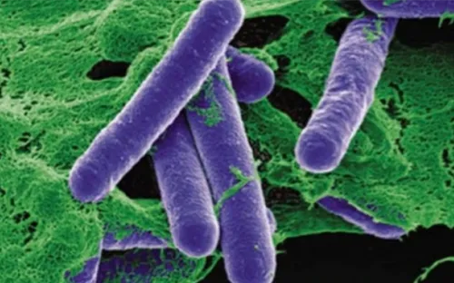 Sở Y tế TP. Hồ Chí Minh thông tin về 2 trường hợp nghi ngộ độc Botulinum toxin