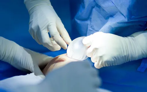 Hạ size túi ngực phụ thuộc vào nhiều yếu tố