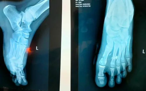 Cảnh báo hiểm họa từ súng hơi tự chế