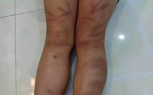 Kiến nghị cơ quan Công an vào cuộc xác minh vụ 6 trẻ mầm non bị đánh