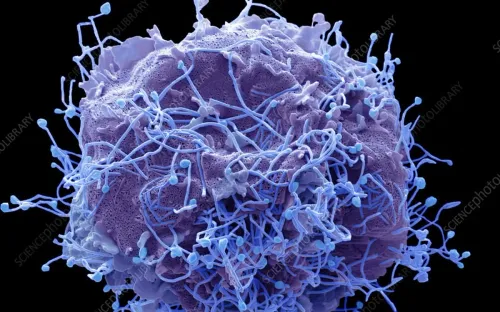 Nga xác định nhóm nguy cơ nhiễm virus HMPV gây bệnh đường hô hấp