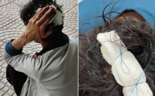 Công an điều tra vụ nam shipper bị chém gục khi giao hàng