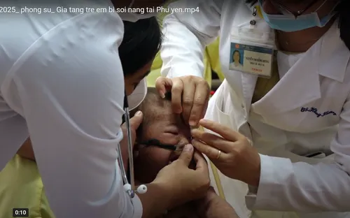 Gia tăng trẻ em mắc sởi nặng nhập viện tại Phú Yên