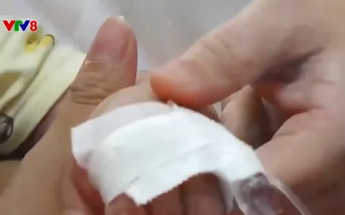 Dịch sởi diễn biến phức tạp tại Đà Nẵng