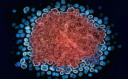 Thái Lan báo động gia tăng ca nhiễm HIV trong giới trẻ