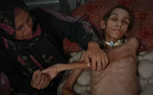 Tây Ban Nha tiếp nhận trẻ em Palestine điều trị y tế khẩn cấp