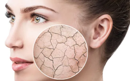 Bí quyết chống khô da hiệu quả trong mùa thu