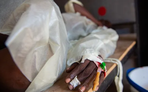 WHO báo động về dịch tả trên toàn cầu