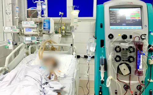 Nguy kịch vì mò đốt