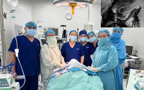 Cảnh giác tai nạn chó cắn: Bé trai 5 tuổi suýt bị hủy hoại gương mặt