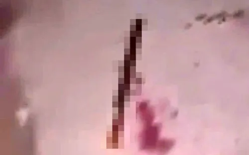 Nam thanh niên 17 tuổi ở Lâm Đồng bị chém đứt lìa bàn tay