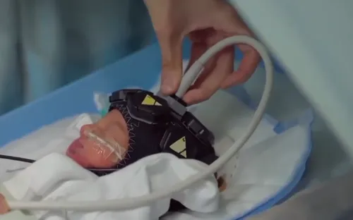 Thử nghiệm công nghệ theo dõi não bộ trẻ em tại Anh