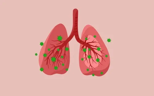 Infographic: Dấu hiệu cảnh báo sớm viêm phổi ở trẻ