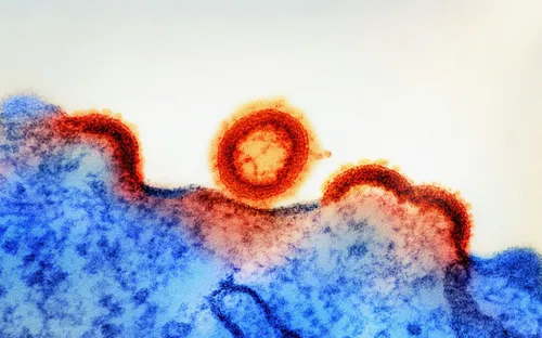 Báo động tình trạng lây nhiễm HIV/AIDS ở Philippines