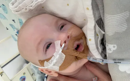 Bùng phát tình trạng ngộ độc botulinum ở trẻ sơ sinh tại Mỹ