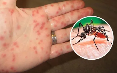 Căn bệnh sốt xuất huyết: Mỗi ngày cướp đi sinh mạng 13 người, cảnh báo dịch chuyển ra miền Bắc