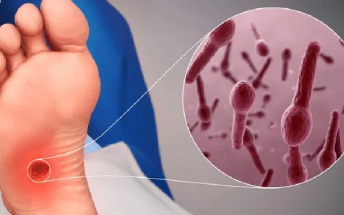 Nguy kịch vì chủ quan với vết thương nhỏ, nhiều bệnh nhân phải thở máy do uốn ván