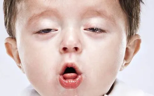 Mỹ ghi nhận số ca mắc ho gà tăng kỷ lục do tỷ lệ tiêm chủng suy giảm