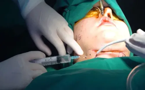 Cảnh báo hệ lụy từ trào lưu làm đẹp cấp tốc và các cơ sở thẩm mỹ chui