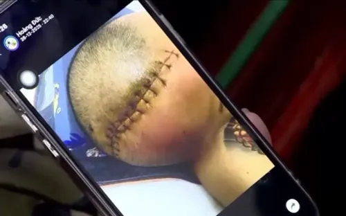 "Địa ngục trần gian" phía sau vẻ ngoài quy củ tại Trung tâm Công tác xã hội Hải Hà