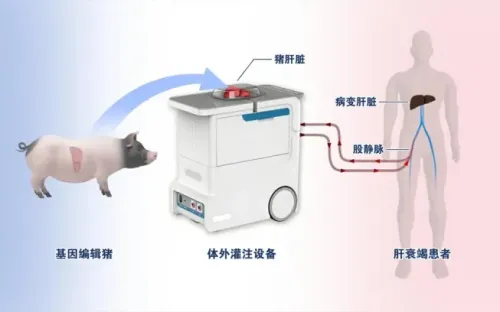 Trung Quốc thử nghiệm thành công gan lợn chỉnh sửa gene hỗ trợ điều trị suy gan