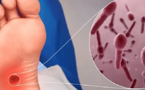 Uốn ván có thể xuất phát từ vết thương nhỏ, diễn tiến nhanh và nguy hiểm