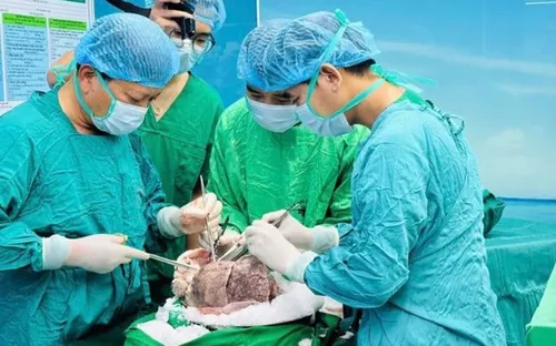 Ghép phổi tại Việt Nam: Quy trình chuẩn Mỹ với chi phí chỉ bằng 1/25