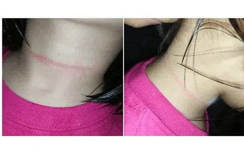 Chuyên gia cảnh báo trào lưu “ngủ 6 giây” trên TikTok có thể gây tử vong