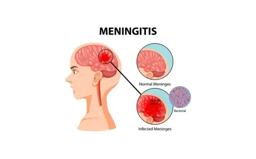 Anh ghi nhận ổ dịch viêm màng não hiếm gặp, 2 người tử vong, hàng chục ca nhập viện