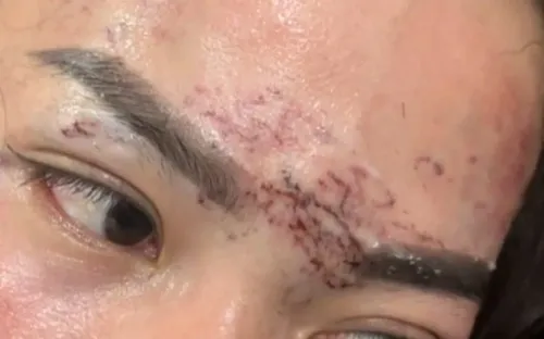 Hai phụ nữ ở Cà Mau lĩnh án tù trong vụ bắt giữ, gây thương tích do ghen tuông