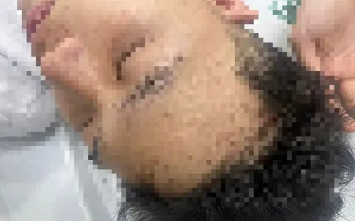 Bắt giữ 2 đối tượng hành hung nam sinh 19 tuổi trên đường Nguyễn Khang