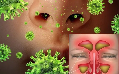 Viêm mũi xoang do nấm xâm nhập: Nguy cơ lan lên mắt, não nếu không phát hiện sớm