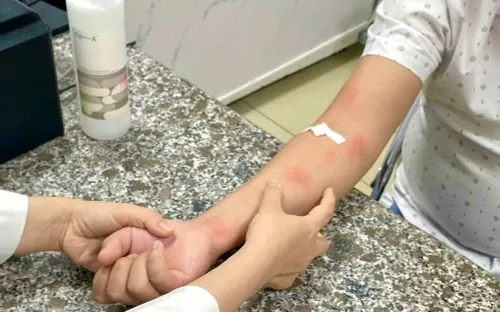 Cảnh báo nguy cơ nhiễm giun sán từ chó mèo gây ngứa kéo dài, nổi mẩn dai dẳng