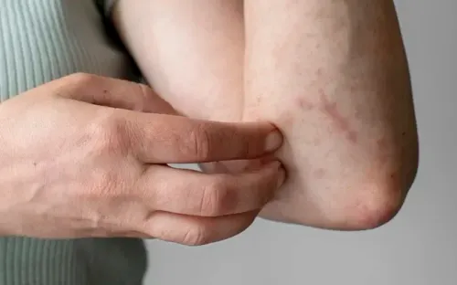 Ngứa kéo dài, mất ngủ có thể là dấu hiệu suy thận nặng