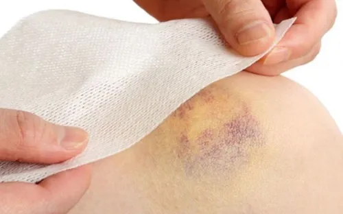 Đi khám sỏi thận, cụ bà ngoài 70 tuổi bất ngờ phát hiện ung thư máu