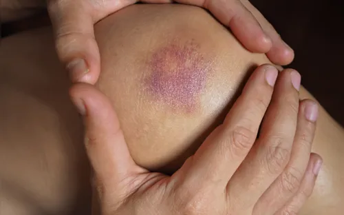 Những dấu hiệu cảnh báo cơ thể thiếu vitamin không nên bỏ qua