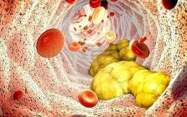 Vì sao kiểm soát đường huyết tốt vẫn có thể bị suy thận?