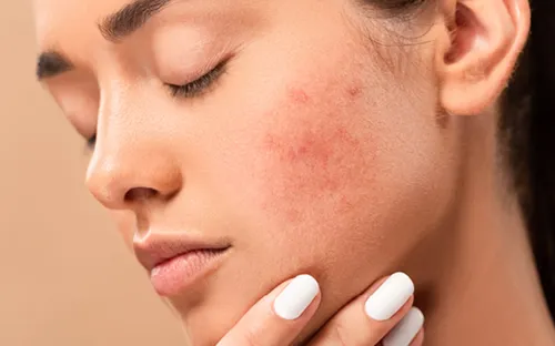 Làm trắng da cấp tốc: Lợi ích trước mắt, rủi ro dài lâu