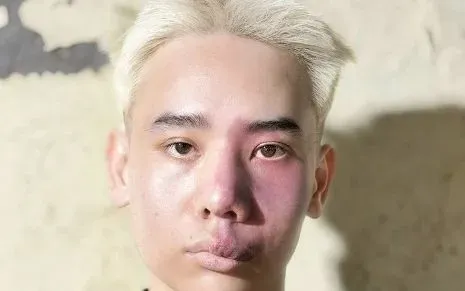 Lợi dụng sơ hở của bạn cùng phòng, thanh niên trộm xe SH mang bán rẻ