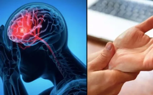 Xuất huyết não trẻ hóa, nhiều người nhập viện trong tình trạng nguy kịch