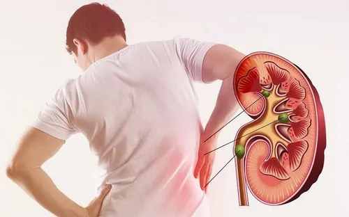 Sau tuổi 40, nguy cơ bệnh thận gia tăng do thói quen ăn uống và bệnh lý nền
